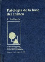 Portada de Avellaneda, Ramon. Patología de la base del cráneo :IV Congreso Nacional de la Sociedad Española de Oto-Neuro-Oftalmologia, Pamplona, 29 y 30 de junio de 1990. Barcelona: Mcr; 1990.