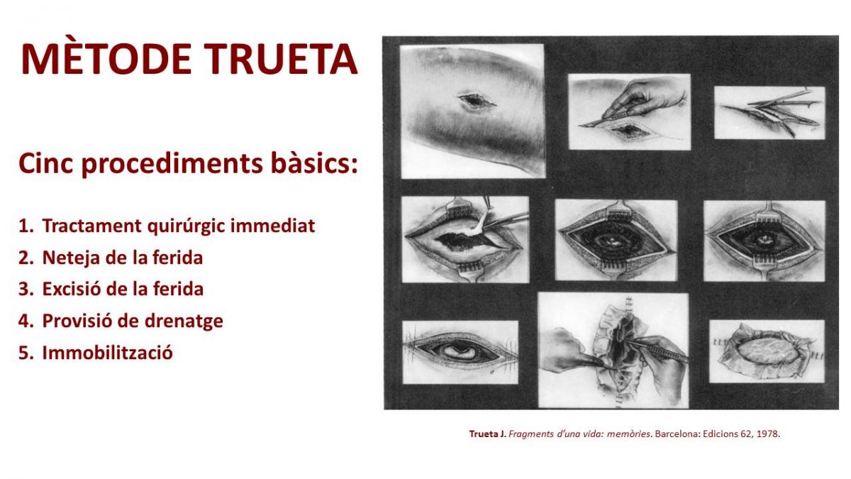 Mètode Trueta. Cinc procediments bàsic. Imatge extreta de "Trueta J. Fragments d'una vida: memòries. Barcelona: Edicions 62, 1978."